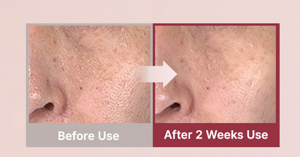 Arencia - Fresh Red Smoothie Serum 30 (50 g)